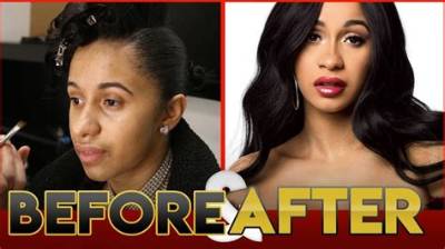 Cardi B's Bold Transformation: from Cosmetic Speculation to That $15K Piercing