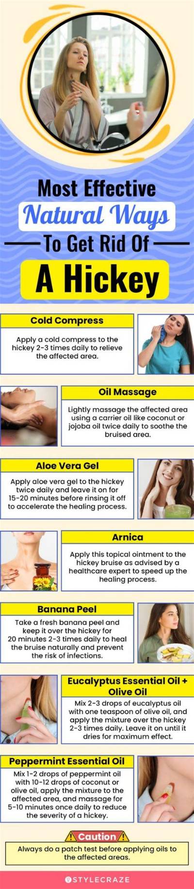 How to Get Rid of a Hickey Fast: Proven Home Remedies and Concealing Tricks