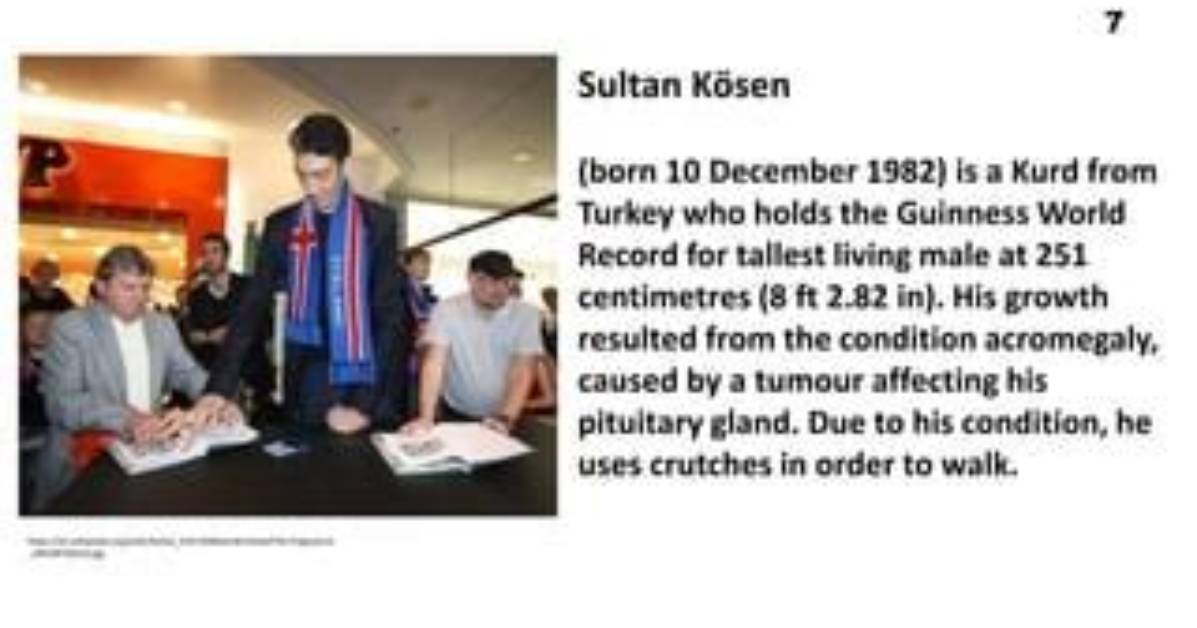 Is Sultan K%C3%B6Sen Still the Tallest Man 400. Jpg